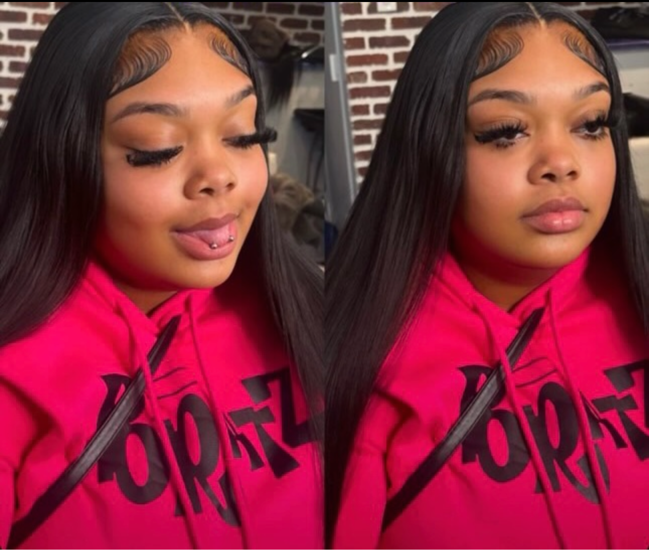 Frontal Straight